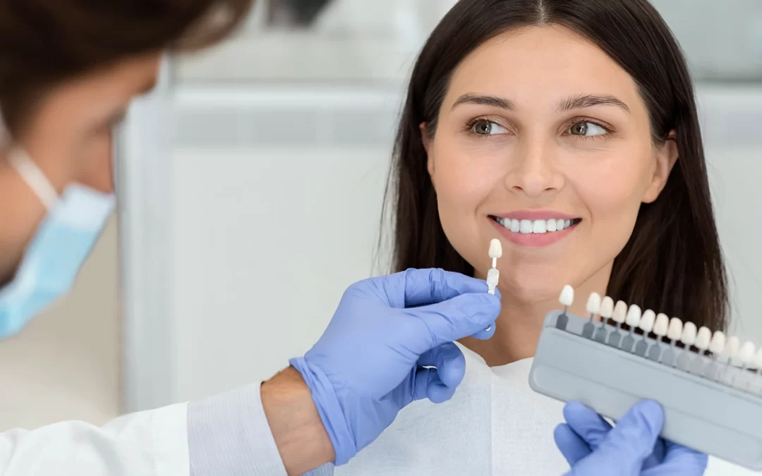 Dental Veneers