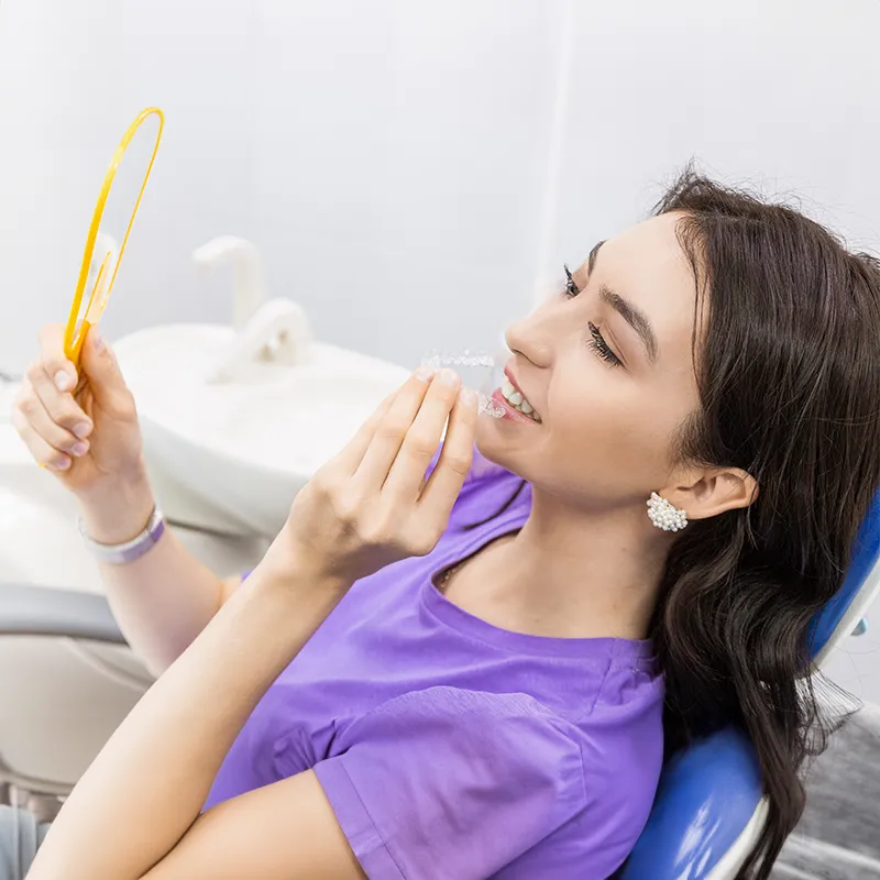 clear aligners