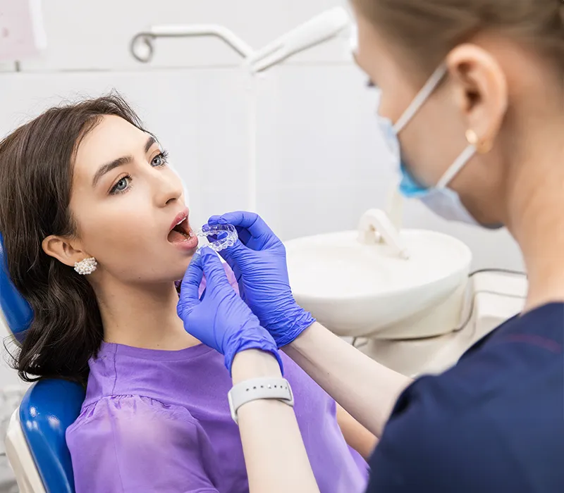 Invisalign clear aligners