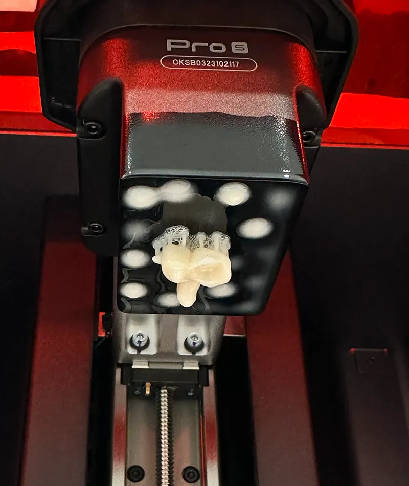 3D printed dental crowns