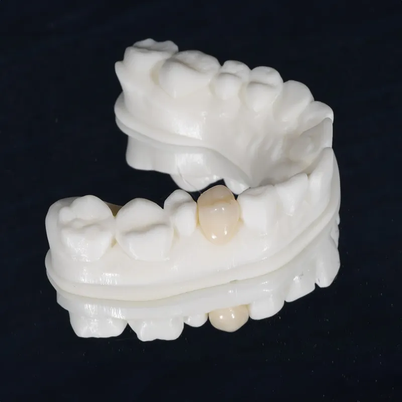 3d printed restorations mockup