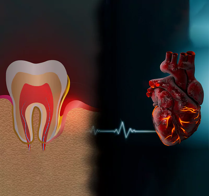 gingivitis heart health