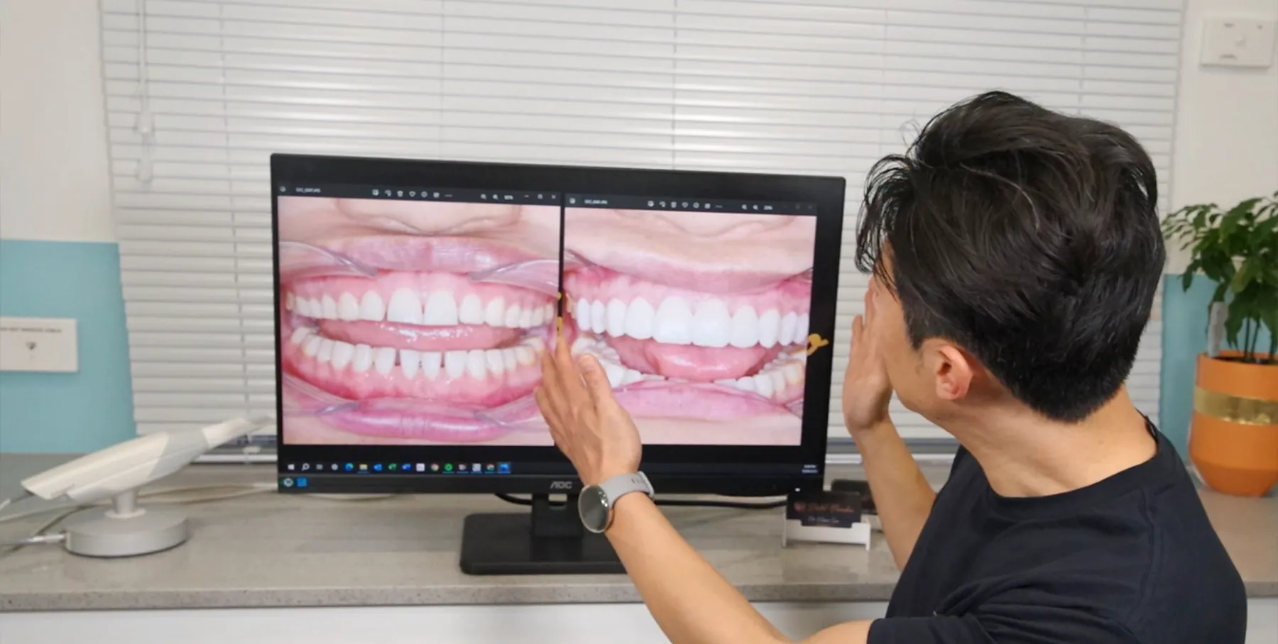 Cosmetic dental treatments for special occasions