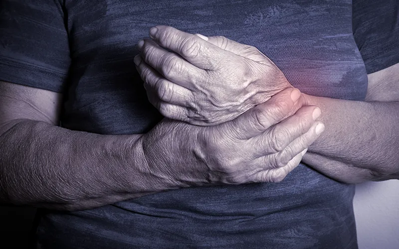 Rheumatoid arthritis