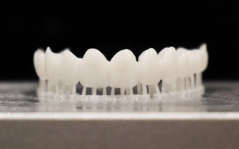 3D printed dental veneers