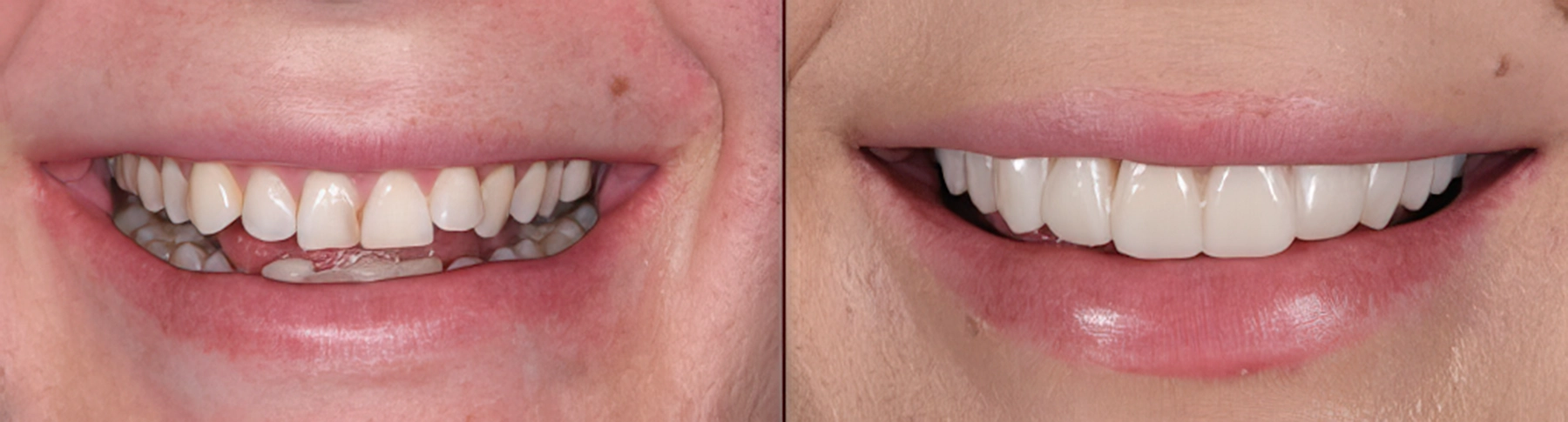 Dental works transformation