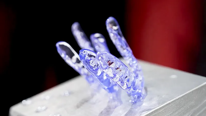 3D-Printed Night Guards