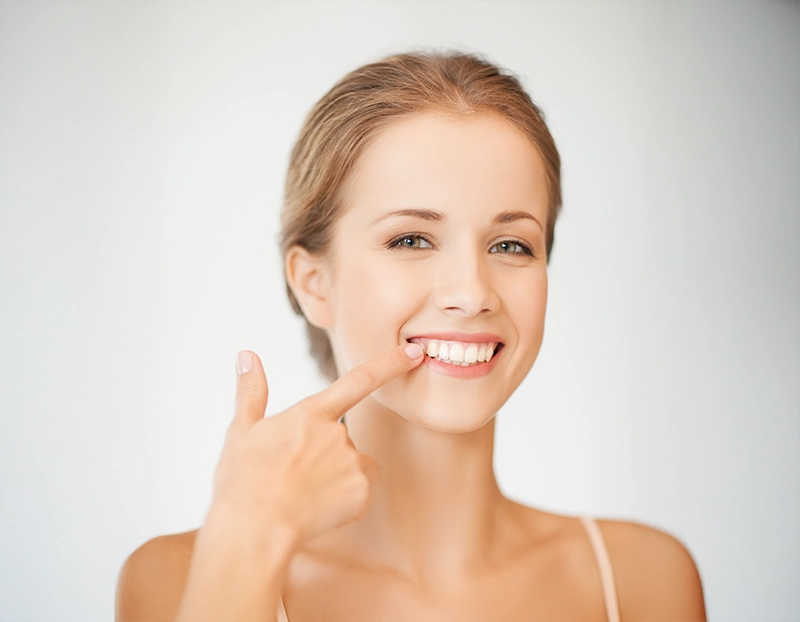 Porcelain veneers
