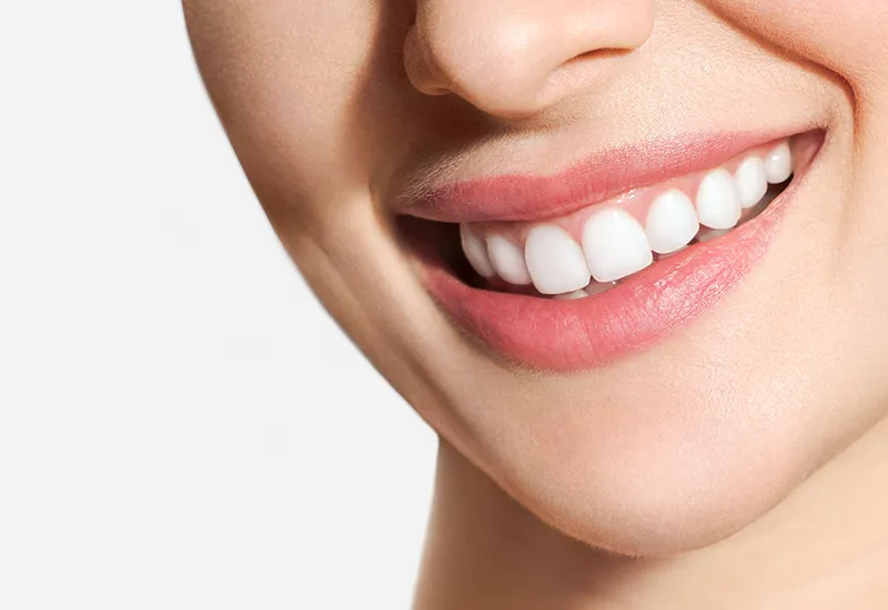 Gummy Smiles